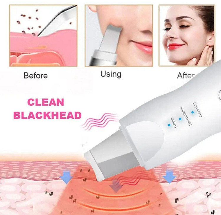 اتوی صورت شارژی
